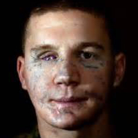 Kyle Carpenter at Walter Reed